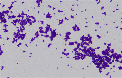 Flickriver: Most interesting photos tagged with staphylococcus