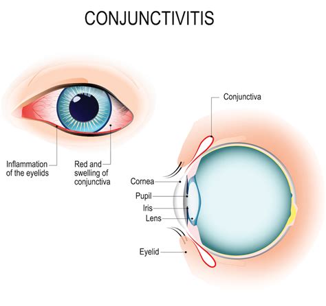 Eye Anatomy Conjunctiva