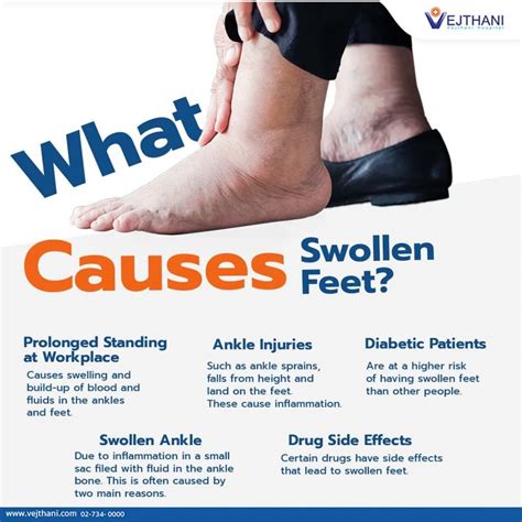 What Causes Swollen Feet?