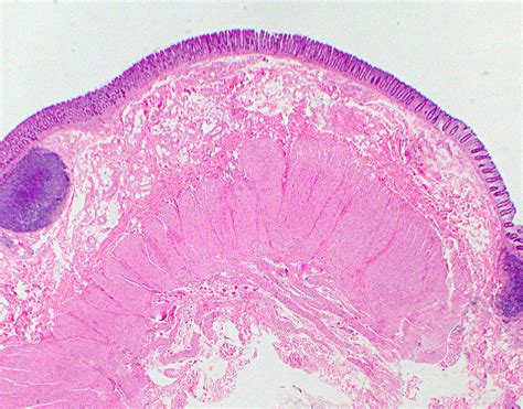 Colon Histology