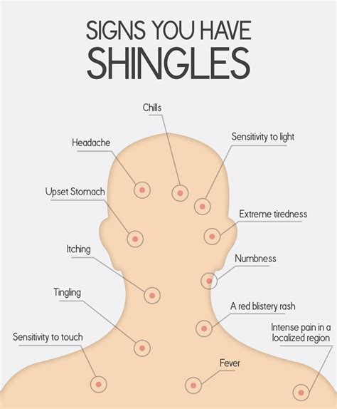 What Is Shingles: Causes, Symptoms and Contagiousness – The Amino Company