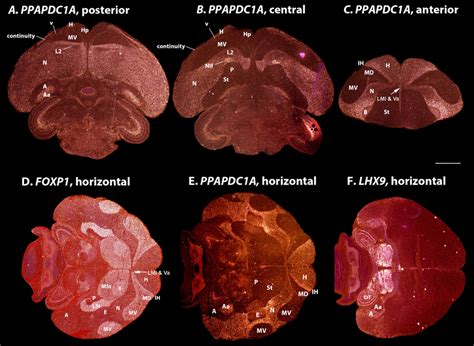 Examples of striatum enriched genes. A: Dopamine 1A (D1A) receptor is ...