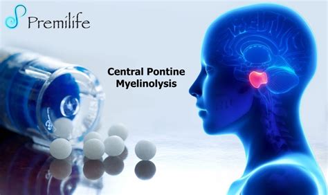 Central Pontine Myelinolysis | Premilife - Homeopathic Remedies