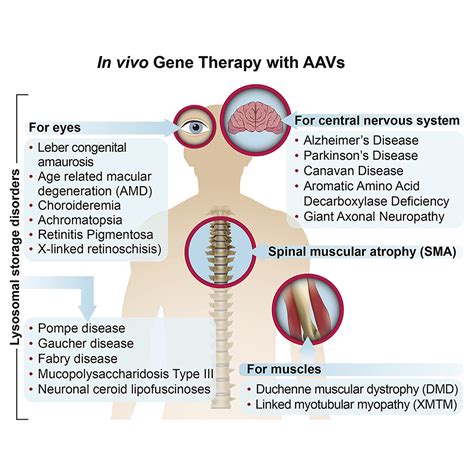 Current Clinical Applications of In Vivo Gene Therapy with AAVs ...