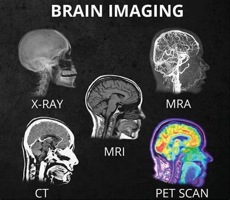 Cat Scan Vs Mri Vs Xray