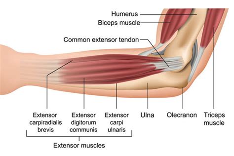 Thrower's Elbow Treatment & Prevention | Pitcher's Elbow