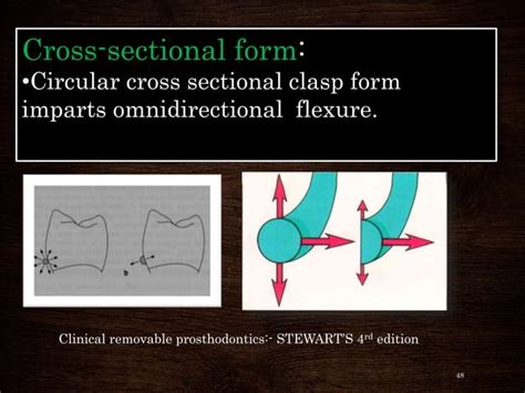 Clasp Designs - Dr. devi | PPT