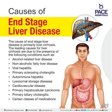 Liver Cirrhosis Symptoms Skin