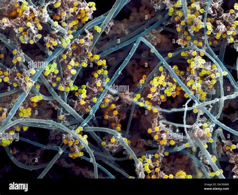 Giant puffball (Calvatia gigantea) spores, coloured scanning electron ...