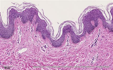 Stratified Squamous Epithelium Keratinized Skin