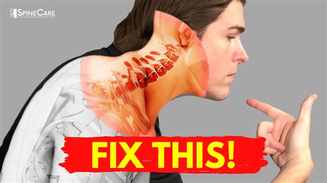 Best Ways to Get Neck Bulging Disc Pain Relief AT HOME | SpineCare