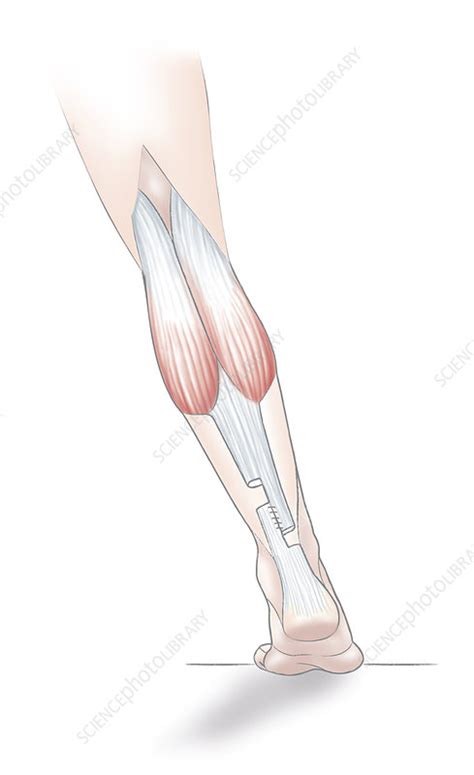 Achilles' Tendon, Drawing - Stock Image - C017/2055 - Science Photo Library