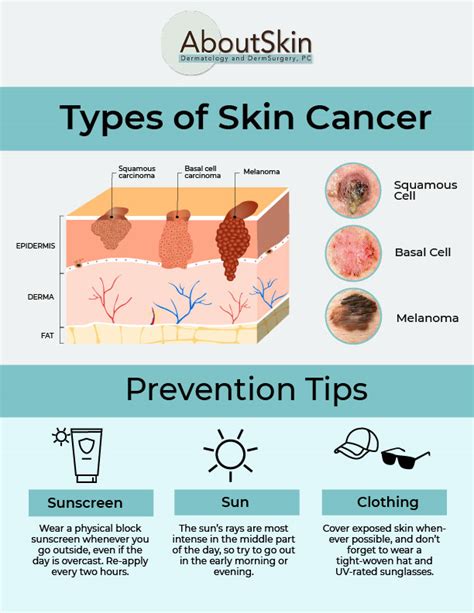 Skin Cancer Treatment