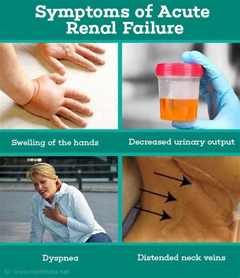 Acute Renal Failure Symptoms