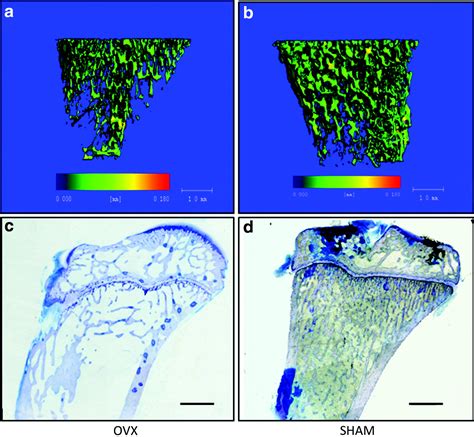 Estrogen deficiency-associated bone loss in the maxilla: A methodology ...