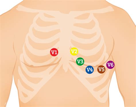 Pediatric Ekg 15 Lead Placement Diagram - diagram back muscles