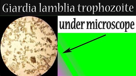 Giardia Lamblia Cyst Under Microscope | Bruin Blog