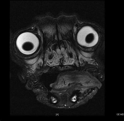 Adorable pug MRI. No surprises here! : r/CuteButHorrifying