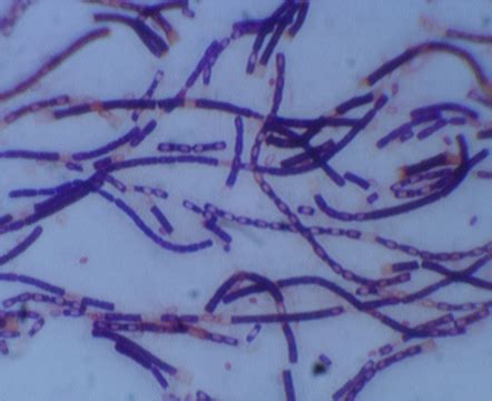 bacillus anthracis