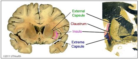 Neuroanatomy Online: Lab 10 (ƒ2) - Internal Organization of the Brain ...