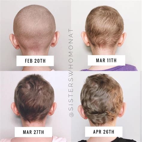 Before and after chemo hair growth - Insane hair growth transformation ...