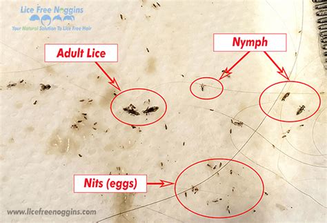 Head Lice: How to Identify Head Lice and Nits