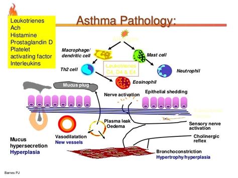 Pathophysiology Of Bronchial Asthma / Asthma For Nurses - Asthma Lung ...