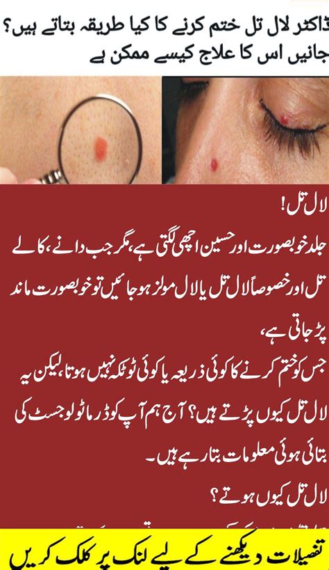 What Can Cause Red Dots To Appear On The Skin | Daily