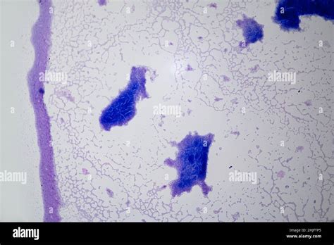 Bacillus Subtilis Microscope