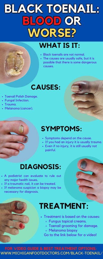 Toe Nail Coming Off the Nail Bed [Causes, Remedies & Best Treatment!]