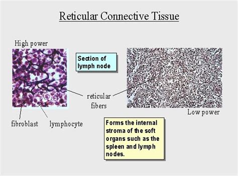 Reticular Fibers Labeled