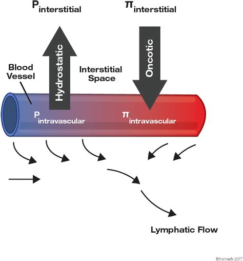 Pulmonary Edema: A Pictorial Review of Imaging Manifestations and ...