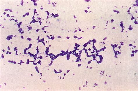 Free picture: photomicrograph, spherical, cocci, gram, positive ...