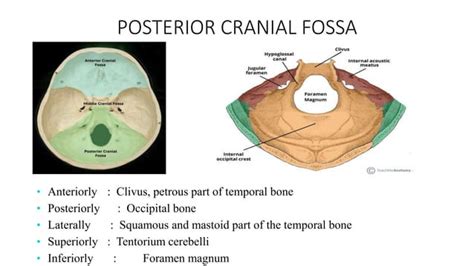 posterior cranial fossa surgery and anaesthesia