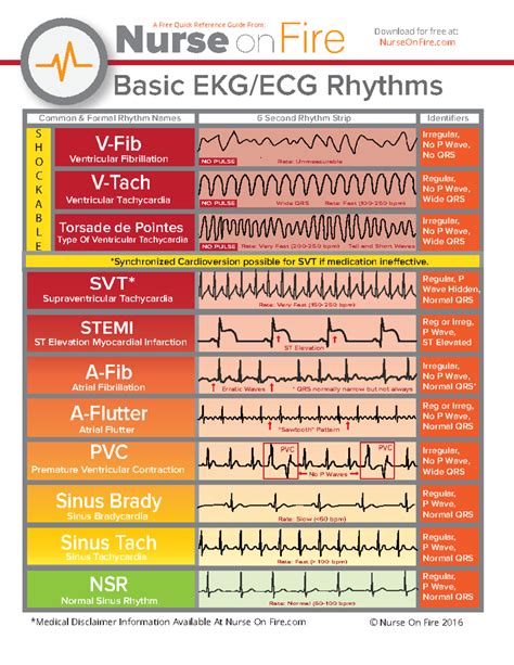 Basic EKG ECG Rhythms Cheatsheet - Copy - Basic EKG/ECG Rhythms V-Fib V ...