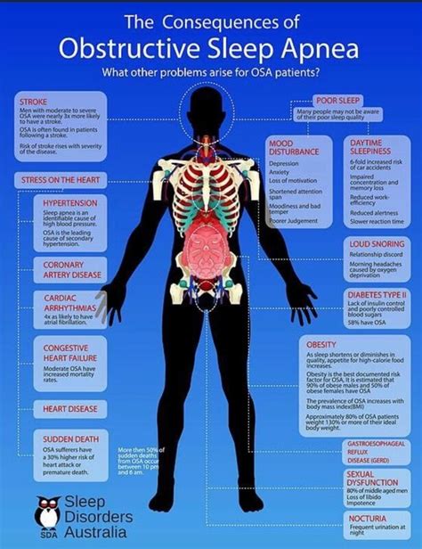 Sleep Apnea Signs and Symptoms