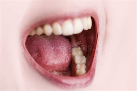 Open mouth and teeth stock photo. Image of dental, skin - 9461714