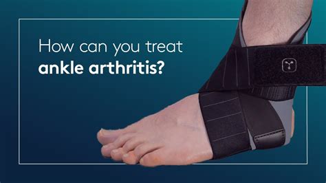 How can you treat ankle arthritis? - YouTube