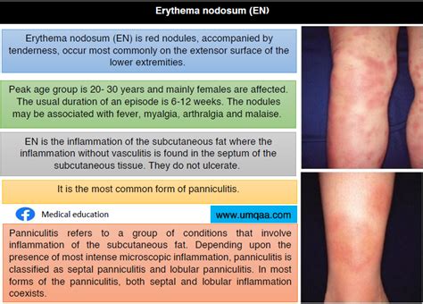 What are the causes of erythema nodosum (EN)?