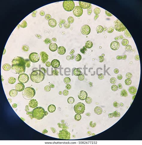 Protoplast Fusion: Over 1 Royalty-Free Licensable Stock Photos ...