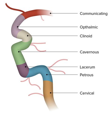 Carotid Arterial System: Anatomy | Concise Medical Knowledge