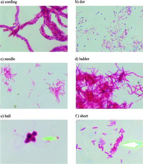 Microscopic Morphology in Smears Prepared from MGIT Broth Medium for ...