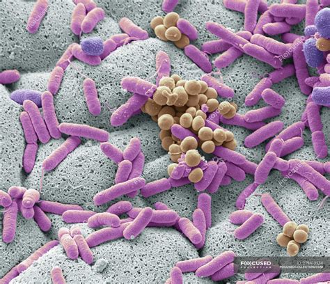 Coloured scanning electron micrograph of bacteria cultured from used ...