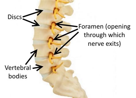 Foraminal Stenosis - Drwolgin