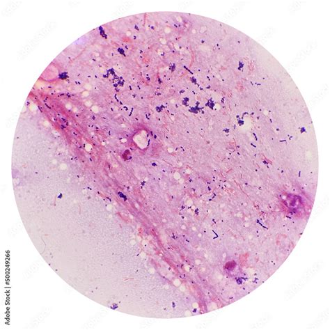 Bacilli Bacteria Microscope