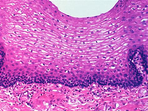 Non Keratinized Stratified Squamous Epithelium - JessieewaHenson