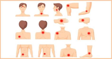 Is myasthenia Gravis Hereditary? | Myasthenia Gravis Prognosis