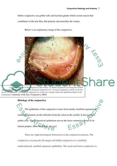 Conjunctiva Histology and Anatomy Essay Example | Topics and Well ...