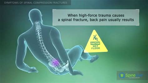 Symptoms Of Low Compression