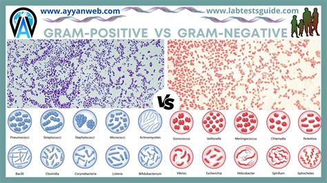 Difference Between Gram-Positive And Gram-Negative Bacteria | Lab Tests ...